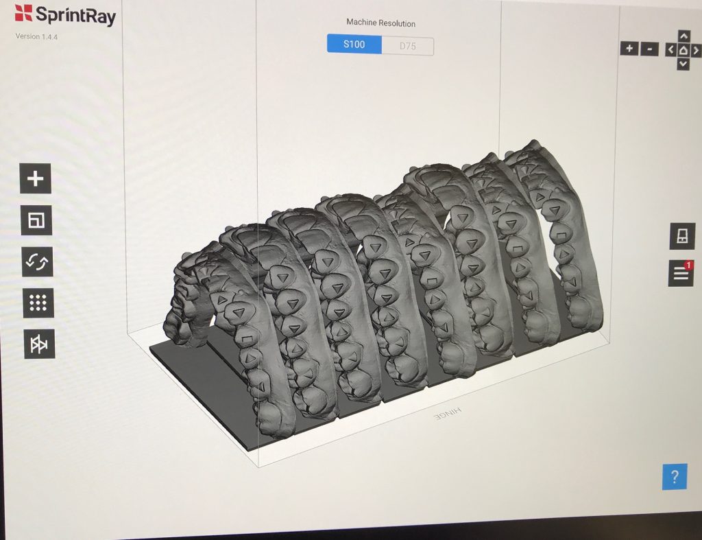 Clear Aligners in Carrington ND Clear Braces near Jamestown and