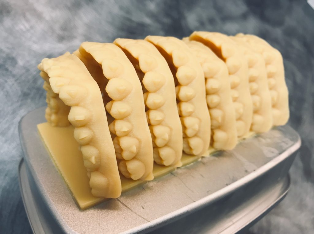 Clear Aligners in Carrington ND Clear Braces near Jamestown and