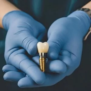 dental implant dentist in Carrington, ND